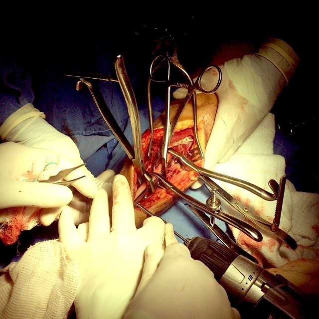Cirugía realizada por un traumatólogo